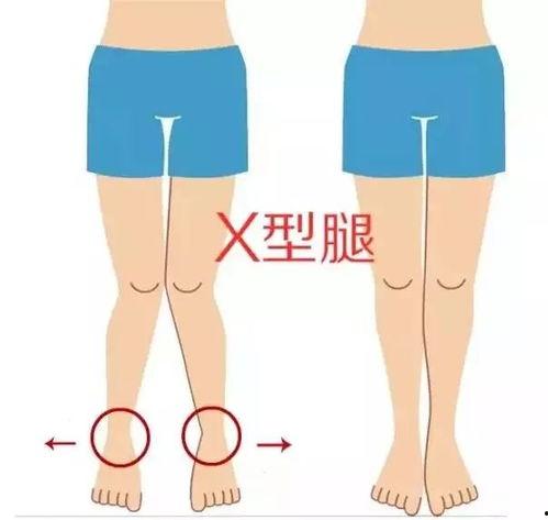 哪个明星是x型腿,揭秘明星身材秘密